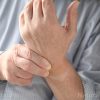 Investigating the efficacy of acupuncture for treating rheumatoid arthritis of the hand