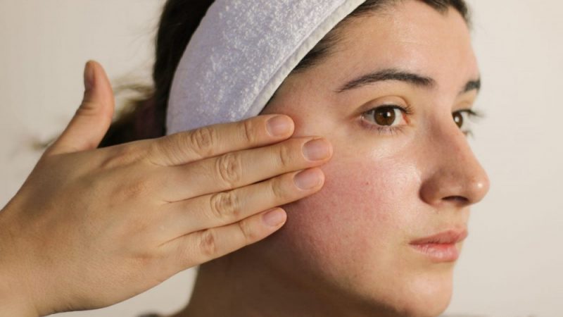 Can You Get Rid Of Rosacea? Here’s What Experts Say