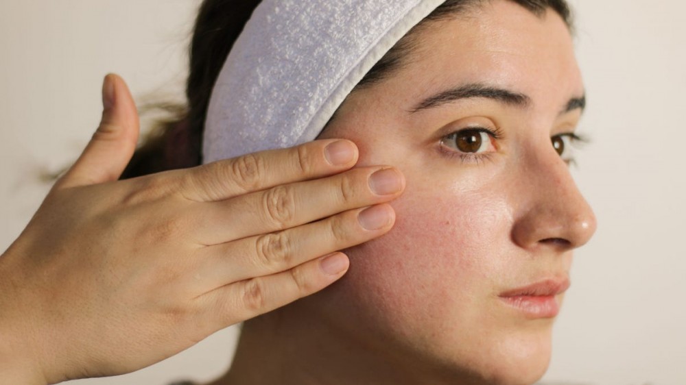 A woman with rosacea touches her face