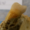 Rare traces of tooth decay and gum disease found in Bronze Age teeth