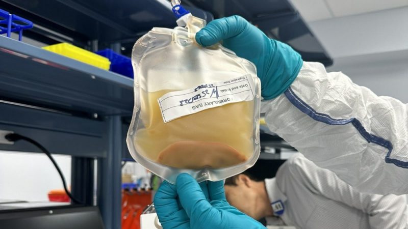 Experimental treatment grows livers from lymph nodes